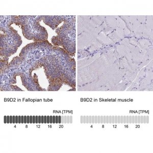 Anti-B9D2 antibody produced in rabbit 