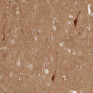 Anti-BAALC antibody produced in rabbit 