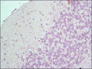 Anti-BACE 1, C-Terminus (485-501) antibody produced in rabbit B0806-.2ML