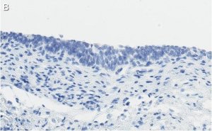 Anti-Bak Antibody, clone 2D18 ZooMAb� Rabbit Monoclonal 