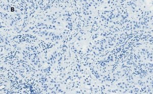 Anti-Bax Antibody, clone 1C7, ZooMAb� Rabbit Monoclonal 