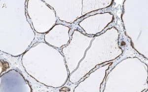 Anti-Bcl-2 Antibody, clone 1K8 ZooMAb� Rabbit Monoclonal 