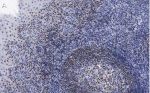 Anti-Bcl11A Antibody, clone 2C4 ZooMAb� Rabbit Monoclonal 