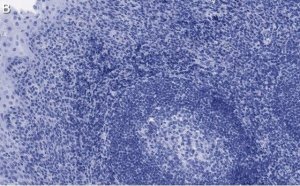 Anti-Bcl11A Antibody, clone 2C4 ZooMAb� Rabbit Monoclonal 