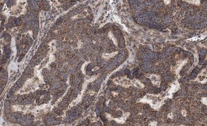 Anti-Beclin 1 Antibody, clone 1E22 , ZooMAb� Rabbit Monoclonal 