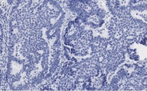 Anti-Beclin 1 Antibody, clone 1E22 , ZooMAb� Rabbit Monoclonal 
