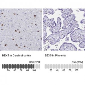 Anti-BEX5 antibody produced in rabbit 