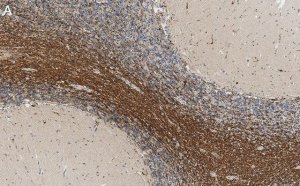 Anti-Bin1 Antibody, clone 99D.2 ZooMAb� Mouse Monoclonal 