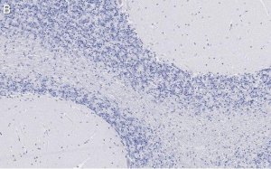Anti-Bin1 Antibody, clone 99D.2 ZooMAb� Mouse Monoclonal 