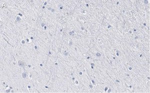 Anti-BLBP/FABP7 Antibody, clone 7I23, ZooMAb� Rabbit Monoclonal 
