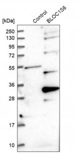 Anti-BLOC1S6 antibody produced in rabbit 