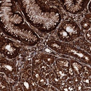 Anti-BLOC1S6 antibody produced in rabbit 
