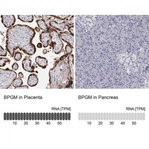 Anti-BPGM antibody produced in rabbit HPA028735-100UL
