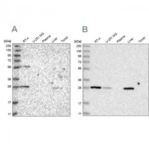 Anti-BPHL antibody produced in rabbit HPA036753-100UL