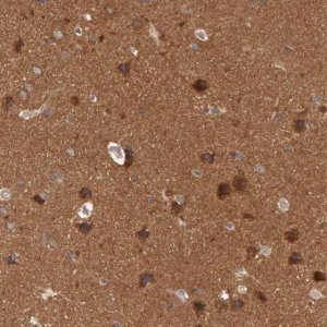 Anti-BRAF antibody produced in rabbit 