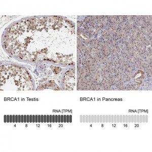 Anti-BRCA1 