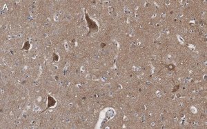 Anti-BSN Antibody, clone 2I2 ZooMAb� Rabbit Monoclonal 