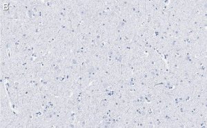 Anti-BSN Antibody, clone 2I2 ZooMAb� Rabbit Monoclonal 