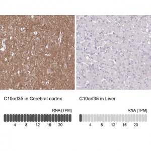 Anti-C10orf35 antibody produced in rabbit 