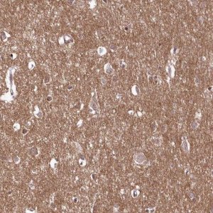 Anti-C10orf35 antibody produced in rabbit 
