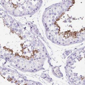 Anti-C11orf42 antibody produced in rabbit 
