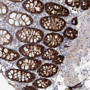 Anti-C11orf52 antibody produced in rabbit 