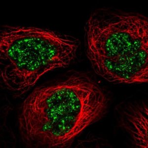 Anti-C11orf84 antibody produced in rabbit HPA050313-100UL