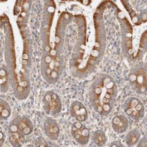Anti-C12orf49 antibody produced in rabbit 