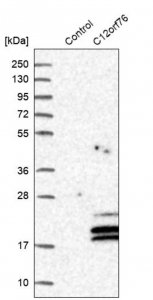 Anti-C12orf76 antibody produced in rabbit 