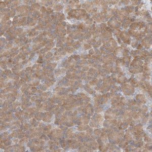 Anti-C16orf58 antibody produced in rabbit 