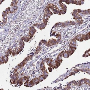 Anti-C19orf24 antibody produced in rabbit 