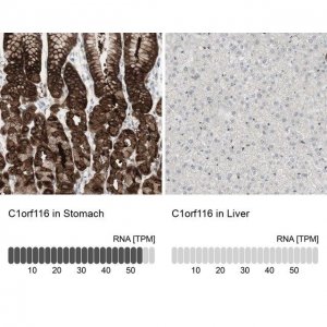 Anti-C1orf116 antibody produced in rabbit HPA011889-100UL