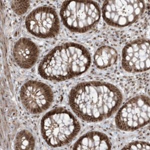 Anti-C1orf52 antibody produced in rabbit HPA036072-100UL