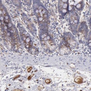 Anti-C1QA antibody produced in rabbit 