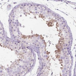 Anti-C20ORF144 antibody produced in rabbit 