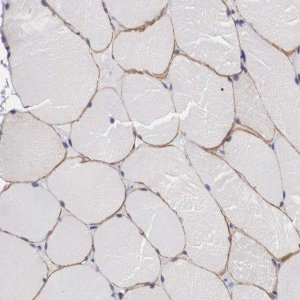 Anti-C22orf31 antibody produced in rabbit 