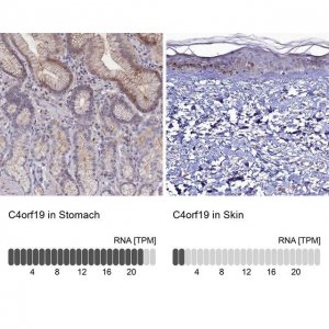Anti-C4orf19 antibody produced in rabbit 