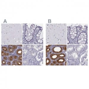 Anti-C6orf58 antibody produced in rabbit 