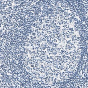 Anti-CA1 antibody produced in rabbit 
