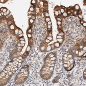 Anti-CA13 antibody produced in rabbit HPA024689-100UL