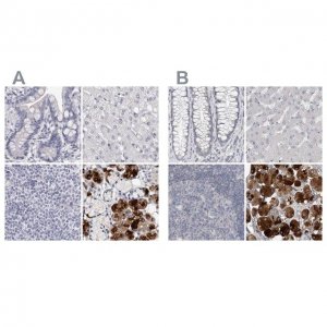 Anti-CA6 antibody produced in rabbit HPA028550-100UL