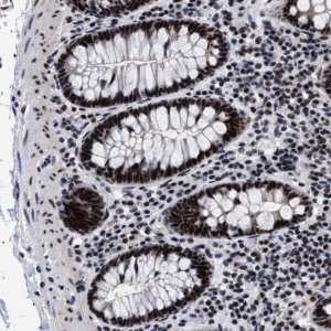 Anti-CAAP1 antibody produced in rabbit 