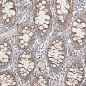 Anti-CAAP1 antibody produced in rabbit HPA024100-100UL