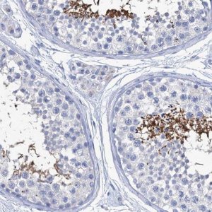 Anti-CABYR antibody produced in rabbit 