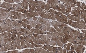 Anti-CACNA1C Antibody, clone 1F20 ZooMAb� Rabbit Monoclonal 