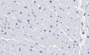Anti-CACNA1C Antibody, clone 1F20 ZooMAb� Rabbit Monoclonal 
