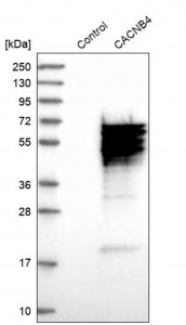Anti-CACNB4 antibody produced in rabbit 