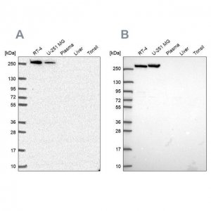 Anti-CAD antibody produced in rabbit 