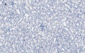 Anti-Calbindin D-28K clone 1A11 Antibody, ZooMAb� Rabbit Monoclonal 