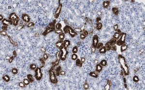 Anti-Calbindin D-28K clone 1A11 Antibody, ZooMAb� Rabbit Monoclonal 